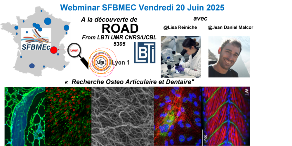 SFBMEc